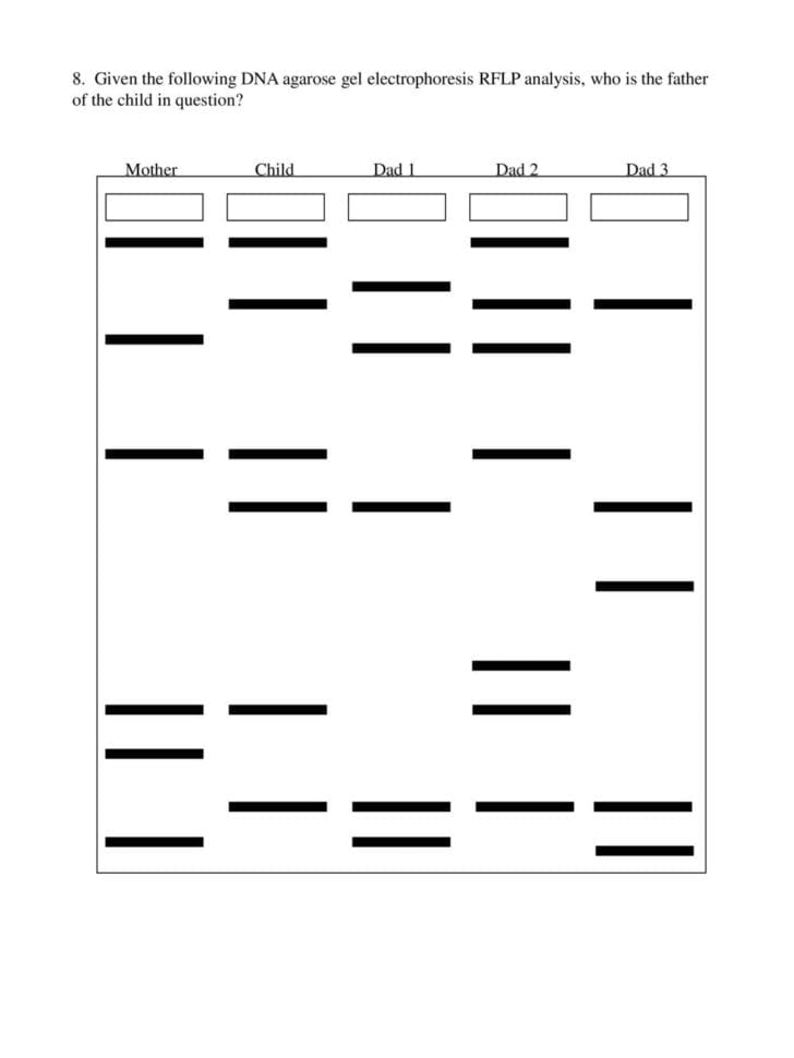 Dna Paternity Test Rflp Analysis  Ppt Download