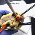 Heart Dissection Lk Through