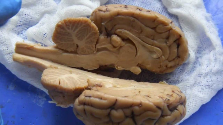 Sheep Brain Dissection Worksheet