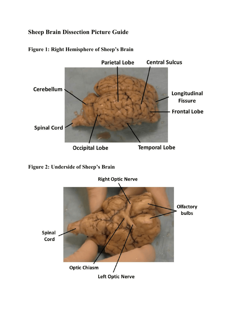 Sheep Brain Dissection Picture Guide
